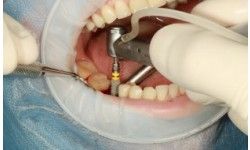 Premium Dental Implants in Sydney – Expert Care & Proven Results