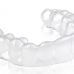 Invisible Braces Cost Sydney – From $1650 for Both Arches Invisible Braces Cost Sydney – From $1650 for Both Arches