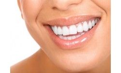 Teeth Whitening in Sydney – Restore the Natural Shade of Your Teeth